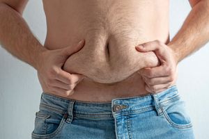 Top 10 Questions On Preventing Loose Skin During Weight Loss