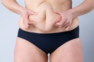 10 Tips To Avoid Loose Skin When Losing Weight